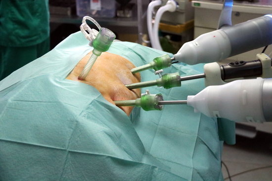 Surgery carried out by a robot (by Àlex Recolons)