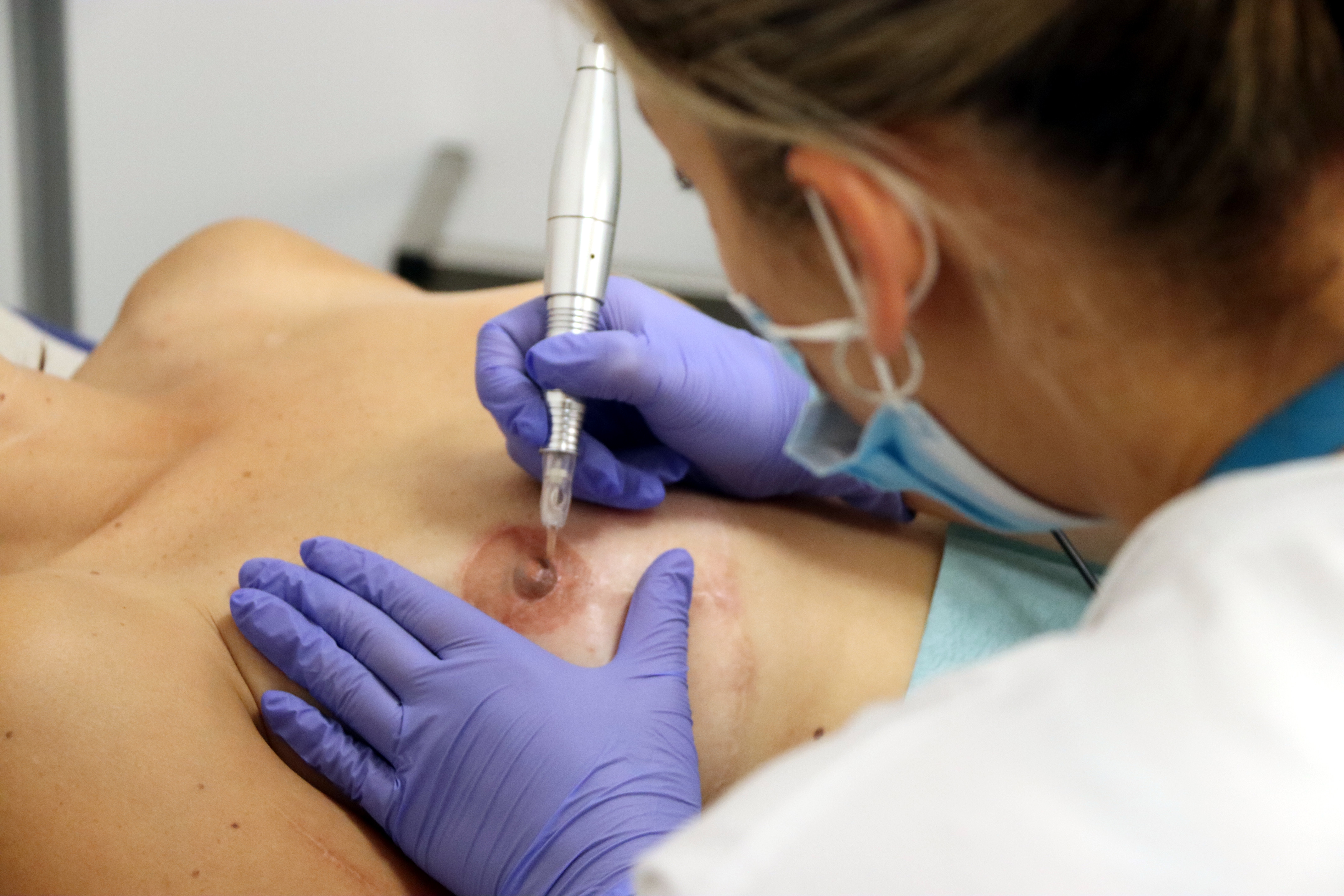 A nurse at the Igualada Hospital rebuilds a breast to a breast cancer survivor