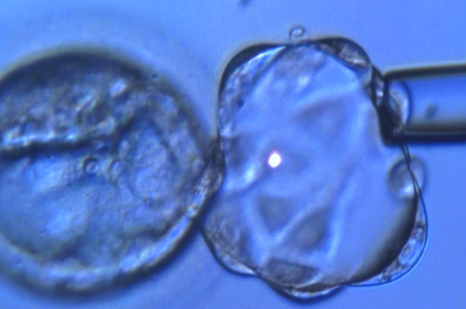 In vitro fertilisation