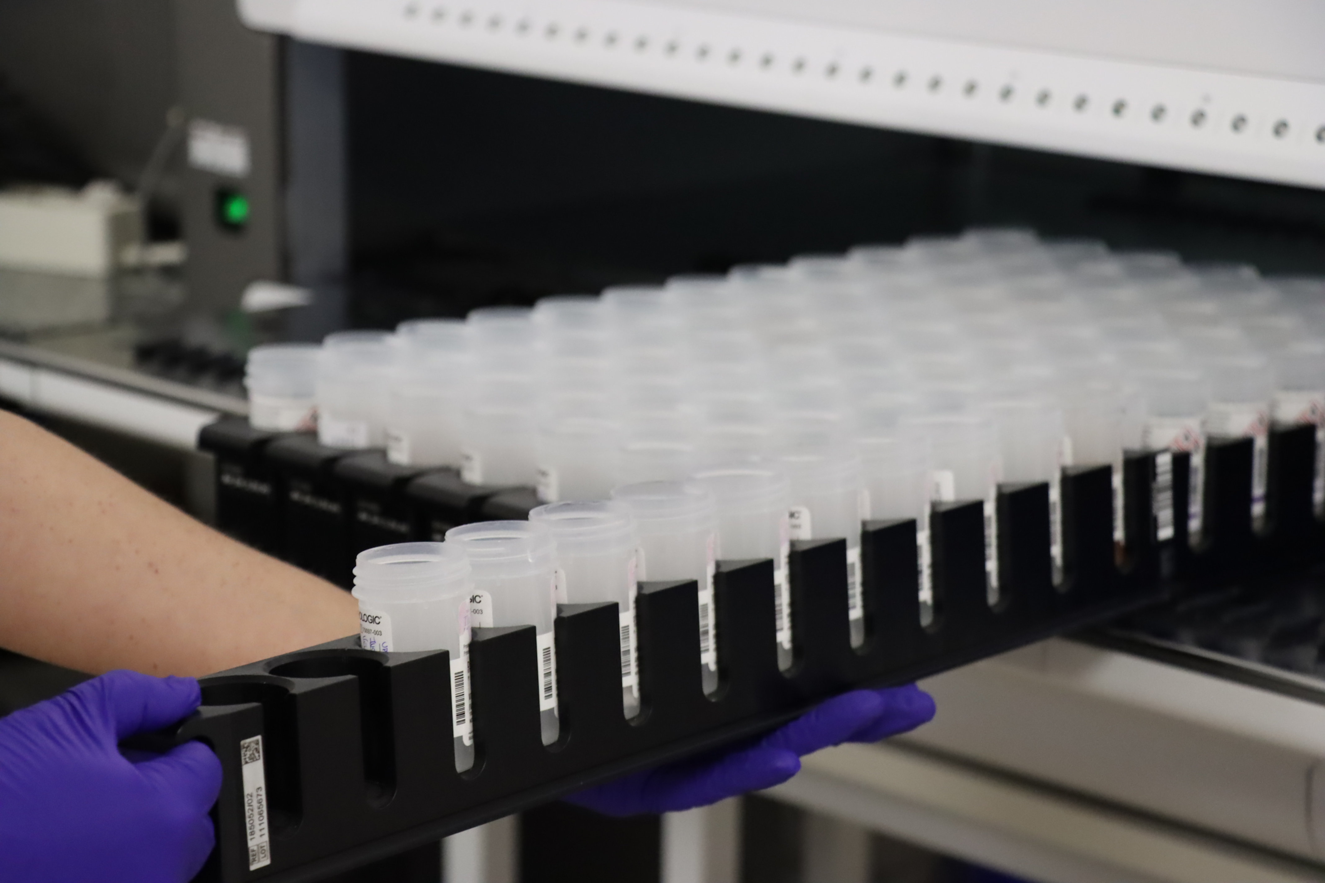 Different samples from women to analyze for traces of HPV and prevent cervical cancer