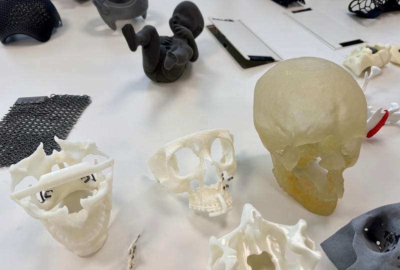 Maxillofacial prototypes created using 3D printing at the Zona Franca Consortium Incubator